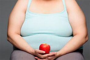 Da biste izliječili proširene vene, morate izgubiti višak kilograma